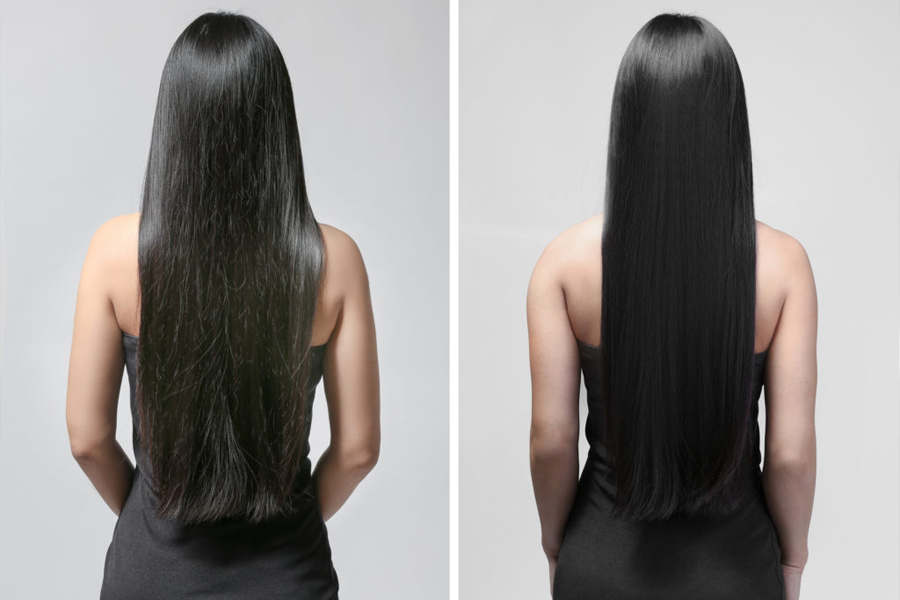 Duỗi Phục Hồi Là Gì? Một Lần Duỗi Phục Hồi Có Giá Bao Nhiêu Tiền?
